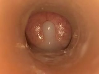 Orgasm